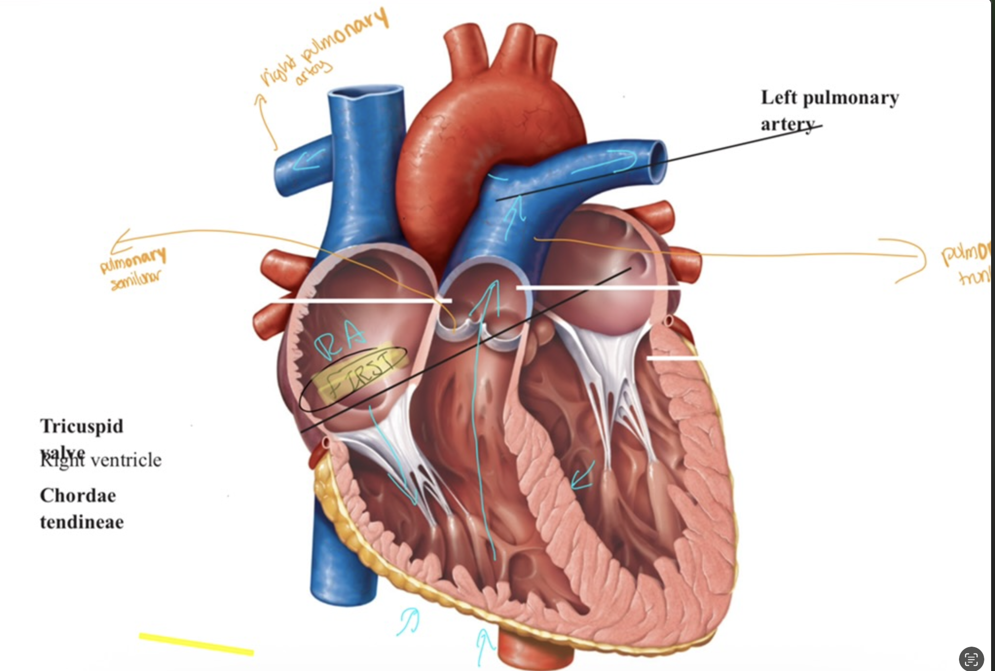 <ul><li><p><span> Right ventricle contracts, </span></p><ul><li><p><span> forces the blood upwards via the <strong>pulmonary semilunar valve</strong>, into the <strong>pulmonary trunk</strong></span></p></li></ul></li></ul><p></p><ul><li><p><span>The <strong>pulmonary trunk </strong>splits into <strong>pulmonary arteries</strong> that bring<br><strong><em>deoxygenated blood </em></strong>to the <strong>lungs</strong> for gas exchange.<br></span></p></li></ul><p></p>