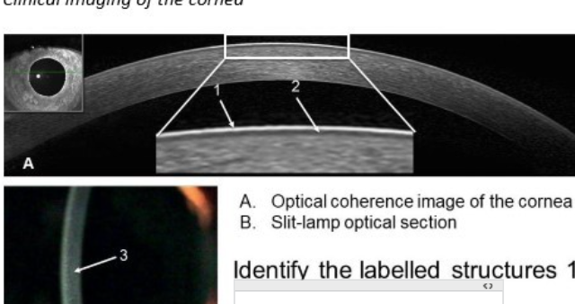 <p>identify stuctures of cornea </p>
