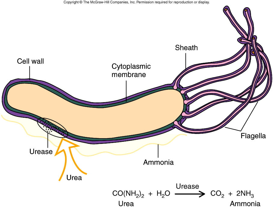 <p><strong>[__] Gastritis</strong>, <strong>Peptic Ulcer Disease,</strong> and <strong>Gastric carcinoma</strong></p><p>Causative agent <strong><mark data-color="purple" style="background-color: purple; color: inherit;">[__]</mark></strong>: <mark data-color="yellow" style="background-color: yellow; color: inherit;">flagellated, Gram-negative spiral</mark></p><p><mark data-color="yellow" style="background-color: yellow; color: inherit;">» survives by neutralizing acidic environment via </mark><strong><mark data-color="yellow" style="background-color: yellow; color: inherit;">urease</mark></strong><mark data-color="yellow" style="background-color: yellow; color: inherit;"> production</mark></p><p>→ breaks down urea to produce ammonia, which shields it from acidity</p><p><span style="color: purple;">» only bacteria known to date to cause a cancer </span><span style="color: rgb(145, 143, 143);">(Gastric carcinoma)</span></p><p></p><p><u><mark data-color="blue" style="background-color: blue; color: inherit;">Pathogenesis</mark></u><mark data-color="blue" style="background-color: blue; color: inherit;">:</mark> after [__] produces urease to neutralize stomach acid,</p><p>» bacterium use flagella to swim through mucous layer of stomach cells and <mark data-color="#f4eeee" style="background-color: rgb(244, 238, 238); color: inherit;">infect epithelial cells → causes damage and kills mucous producing cells</mark></p><p><mark data-color="#f4eeee" style="background-color: rgb(244, 238, 238); color: inherit;">» mucous no longer effectively produced, stomach cells are exposed to acid and gets destroyed </mark>→ <strong>peptic ulcers </strong>and bleeding</p><img src="https://assets.knowt.com/user-attachments/847063bf-d4a2-4be4-9ac5-434d9070bdcf.png" data-width="75%" data-align="center"><p></p>