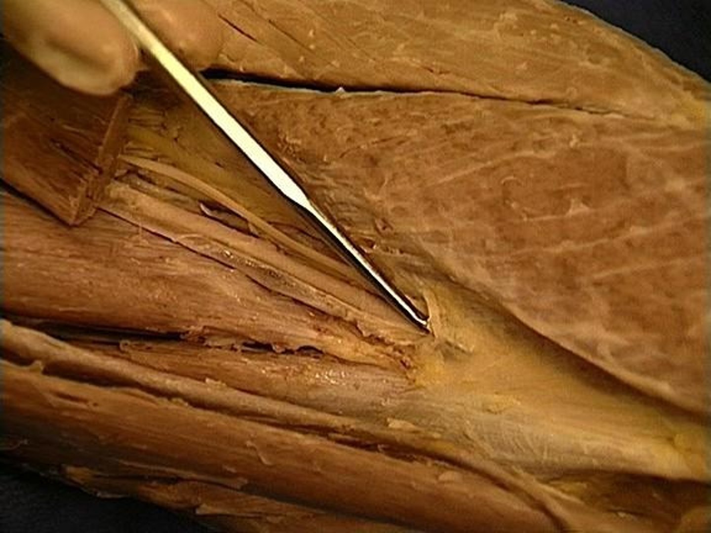 <p>compartment found between quadriceps femoris and medial femoral muscles in the medial 1/3rd of the thigh</p>