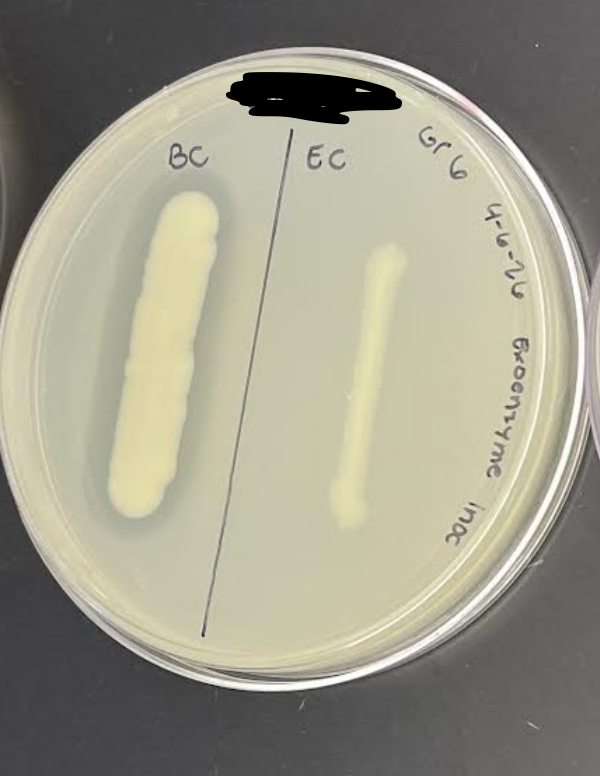 <p>What is the plate used here, what kind of test is conducted, media, incoulation, incubation, theory, results and everything else about it?</p>