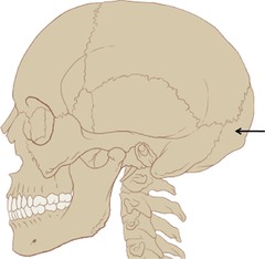 <p>Posterior aspect of the head or base of the skull</p>