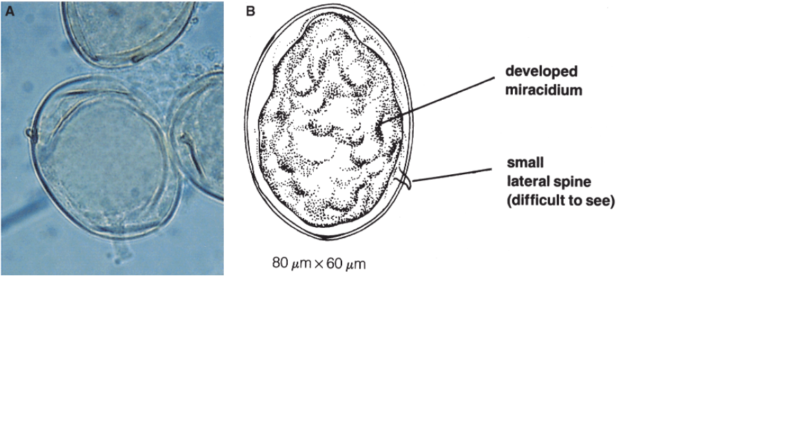 <p>Name the fluke or flatworm</p>