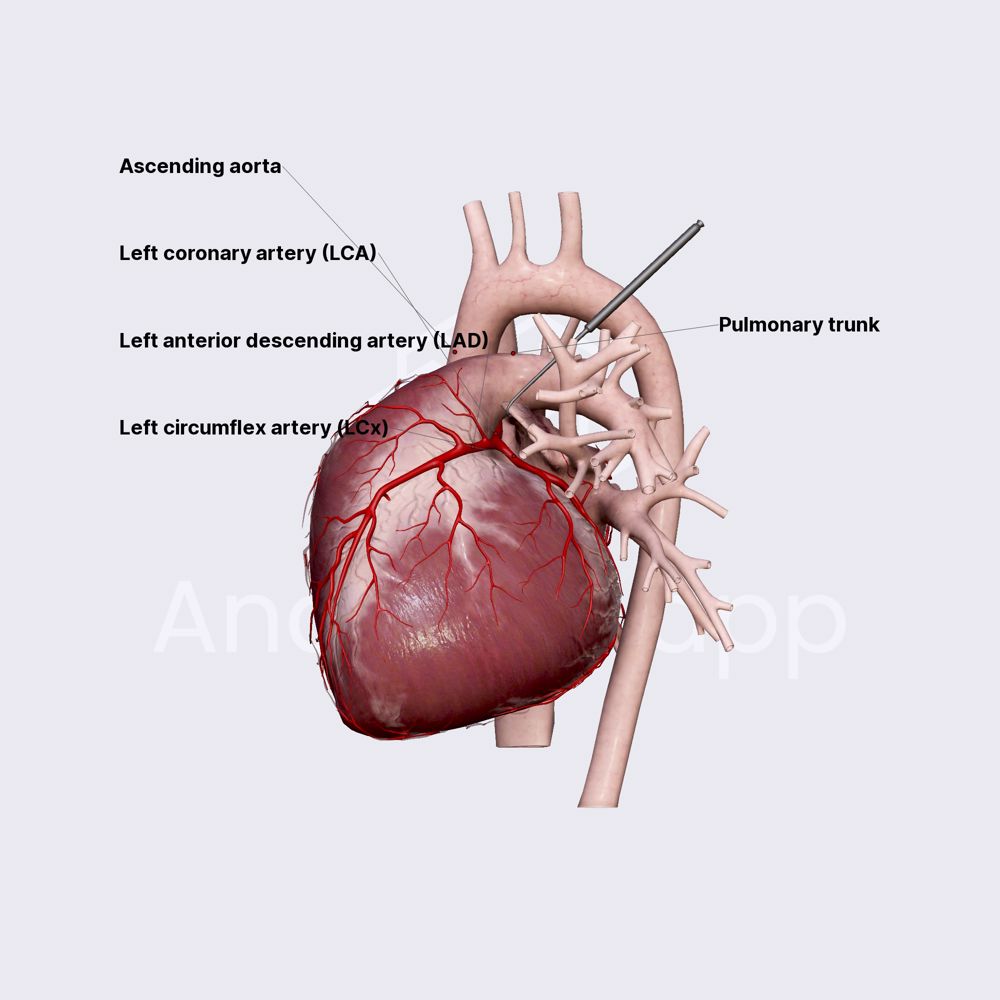 <ul><li><p>Left Coronary Artery (LCA) travels through coronary sulcus under the left auricle and divides into two branches </p></li><li><p>1) the anterior interventricular branch: traveling down the anterior interventricular sulcus to the apex, rounds the bend, and travels a short distance up the posterior side of the heart. it joins the posterior interventricular branch, also called left anterior descending branch (LAD), this artery supplies blood to both ventricles and anterior 2/3s of the interventricular septum </p></li><li><p>2) circumflex branch: continues around the elft side of the heart in the coronary sulcus, gives off left marginal branch that passes down the left margin of the heart and finishes blood to the left ventricle. circumflex branch then ends on the posterior side of the heart. supplies blood to the left atrium and posterior wall of left ventricle </p></li></ul><p></p>