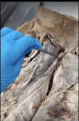 <p>Name the muscle</p><p>- specific area of longissimus</p>