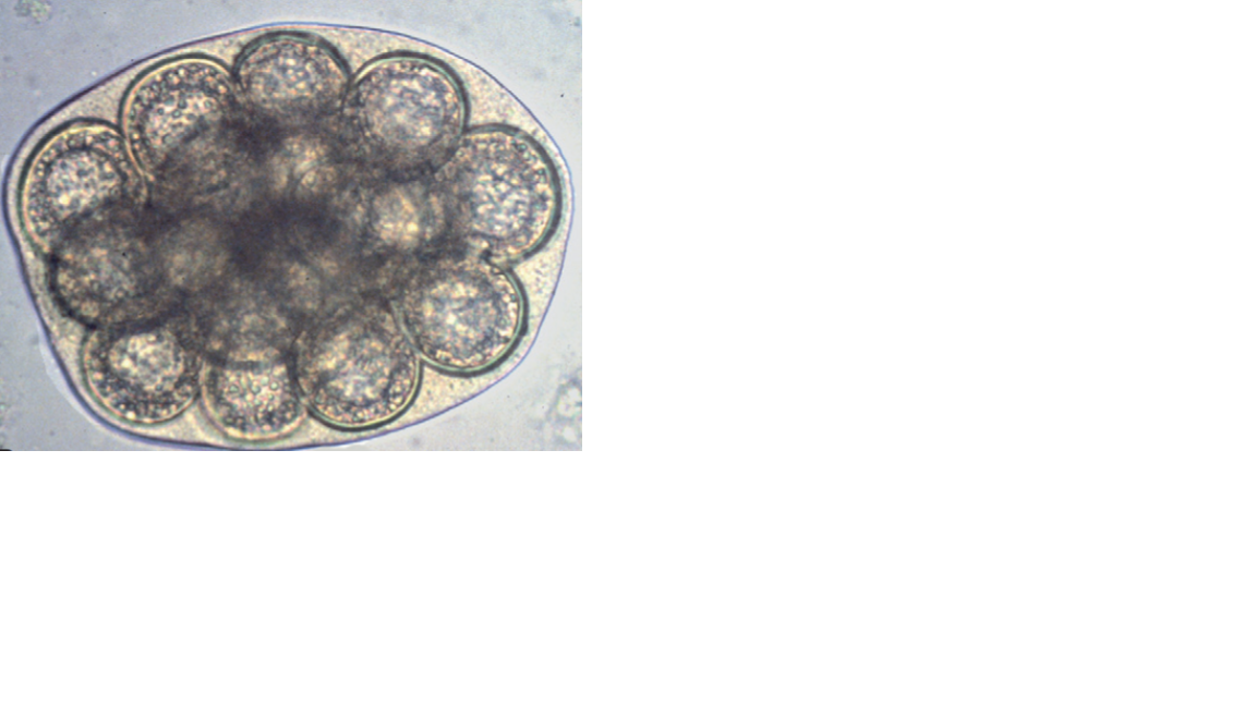 <p>Name the fluke or flatworm</p>
