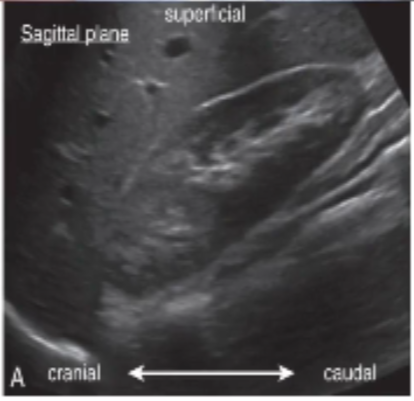 <p>sagittal/longitudinal plane</p>