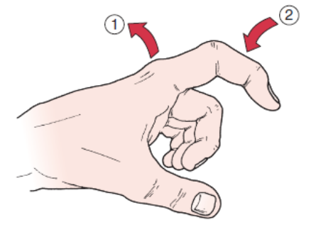 <ul><li><p><span>PURPOSE- Identifies tightness in structures surrounding the MCP joint</span></p></li></ul><ul><li><p><span>DESCRIPTION- The metacarpophalangeal joint is held slightly extended while the examiner moves the proximal interphalangeal joint into flexion, if possible.</span></p></li><li><p><span>RESULT- If the test is positive (which is indicated by inability to flex the proximal interphalangeal joint), there is a tight intrinsic muscle or contracture of the joint capsule. If the metacarpophalangeal joints are slightly flexed, the proximal interphalangeal joint flexes fully if the intrinsic muscles are tight, but it does not flex fully if the capsule is tight. The patient remains passive during the test. This test is also called the <em>intrinsic-plus test</em></span></p></li></ul><p></p>