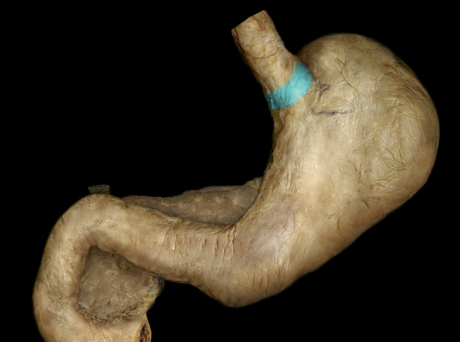 term image