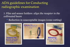 <p>cone cutting (unacceptable images)</p>