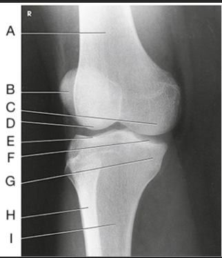<p>What is demonstrated?</p>