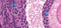 <p>What mitotic phase is each indicated cell in?</p>