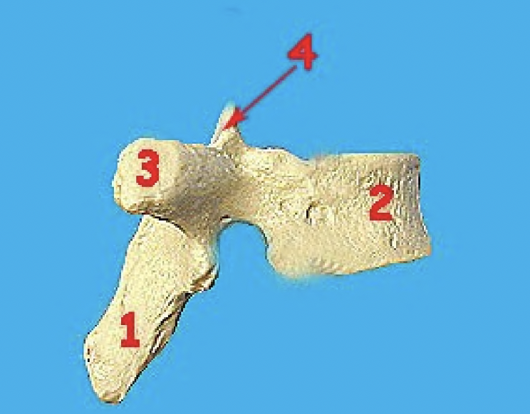 <p>what vertebra is this and what view</p>