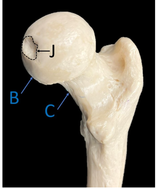 <p>Label B, C, &amp; J. </p>