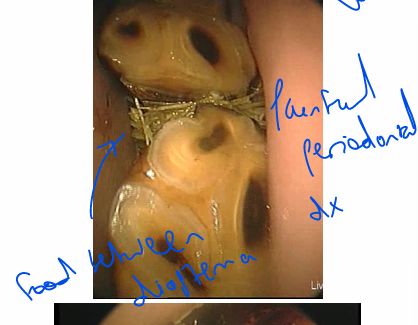 <ul><li><p>Better evaluation of occlusal surface</p><ul><li><p>Fissure fractures</p></li><li><p>Subtle dentinal abnormalities</p></li></ul></li><li><p>Better evaluation of diastemata & periodontium</p></li></ul><p></p><p></p>