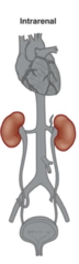 <p>-direct damage to glomerulus or tubules</p><p>-kidney is not filtering blood well</p><p>EX.</p><p>-Acute tubular necrosis (rhabdo, drugs, ischemia)</p><p>-Inflammatory diseases (glomerulonephritis)</p>