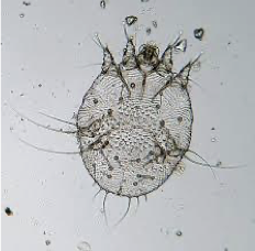 <ul><li><p>causes scabies </p></li></ul><p></p>