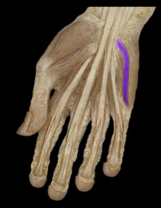<p>What the highlighted structure is acting on the <strong><mark data-color="#28a936" style="background-color: rgb(40, 169, 54); color: inherit;">Hypothernar Group</mark>.</strong> What muscle is this called?</p>