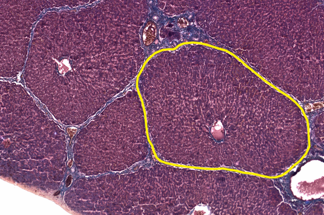 <p>Liver</p><p><strong>NOTICE: THE TIGHTLY PACKED HEPATOCYTES FORMING THE UNIQUE HEXAGONAL SHAPE OF THE LOBULES AND THE LIVER SINUSOIDS THAT SUPPLY THEM WITH NUTRIENTS</strong></p>