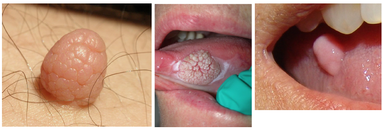 <ul><li><p>flat, raised, or depressed</p></li><li><p>surface texture: smooth, rough (papillary, granular, shaggy, pebbly, ulcerated)</p></li><li><p>consistency on palpation: fluctuant (fluid filled), soft, doughy, rubbery, firm (fibrous), hard</p></li></ul><p></p>