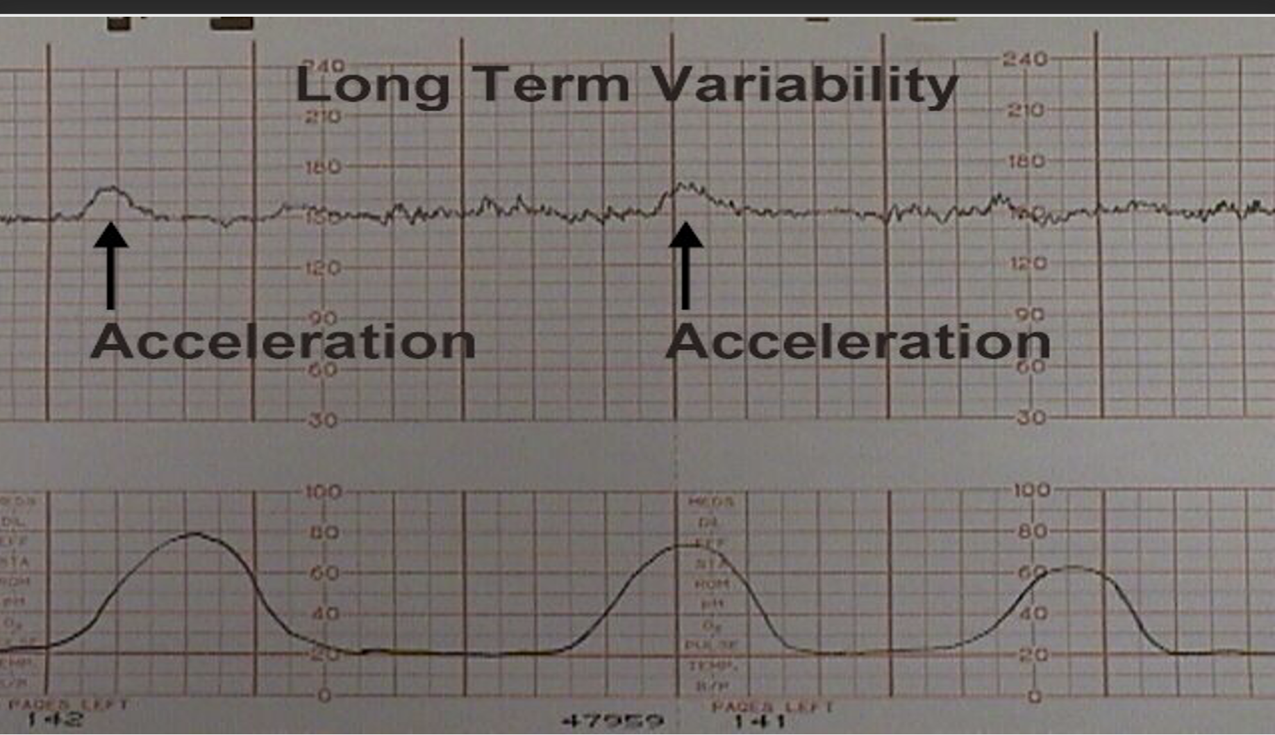 <p>Accelerations</p>
