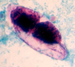 <p>Huge elliptical shaped oocyst? Watery diarrhea?</p>