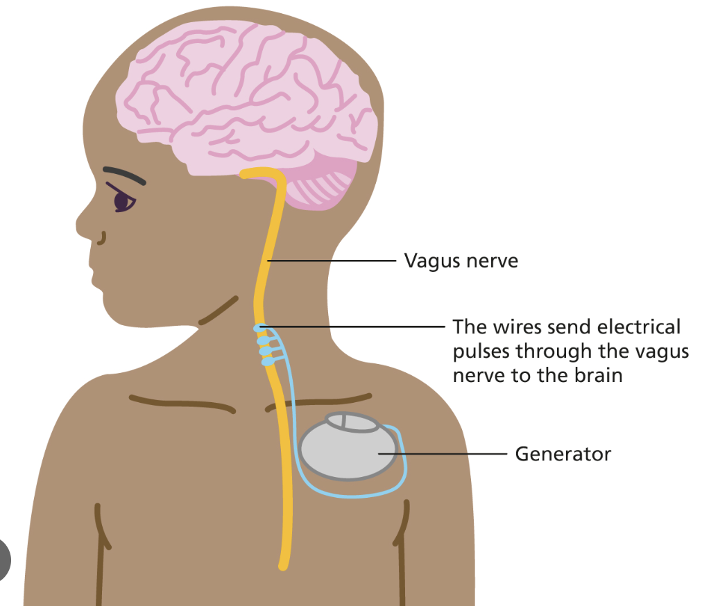 <p>to break episodes of Supraventricular Tachycardia (SVT) or to stop active epileptic seizures in patients with a history of implanted devices.</p>
