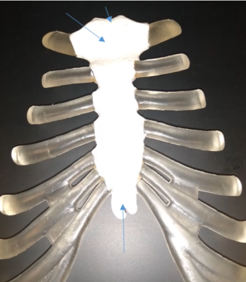 <p>What is the lower part of the sternum called?</p>