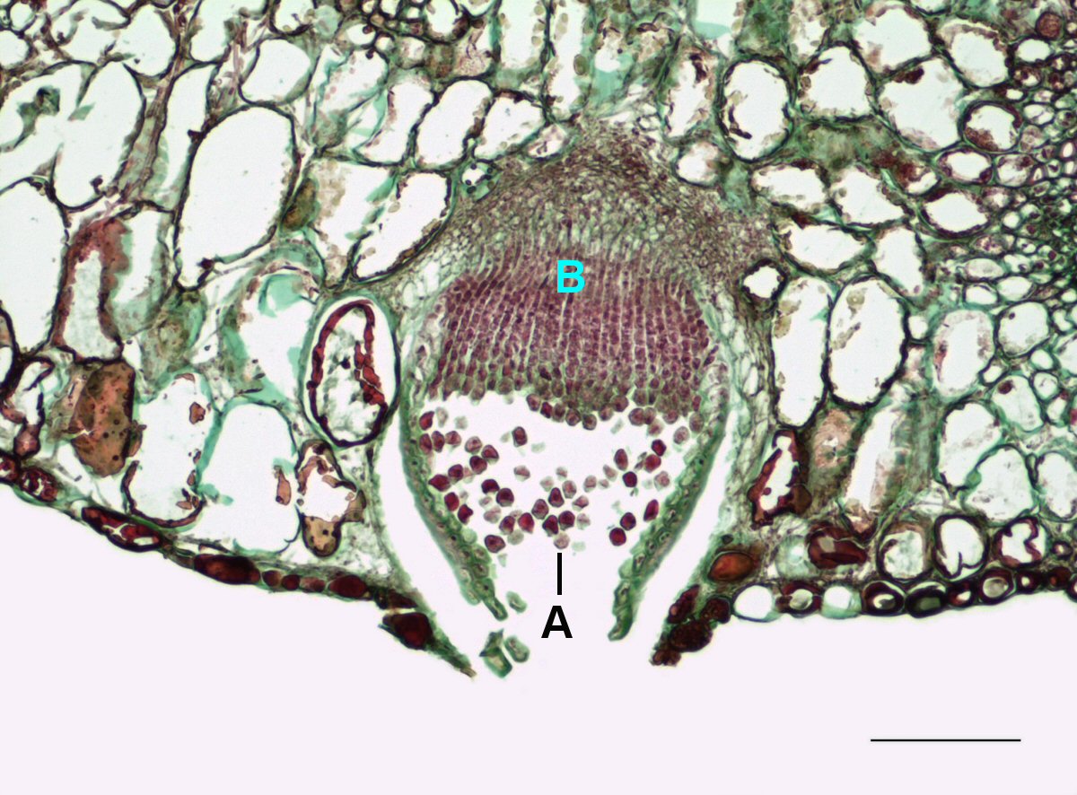 <p>the fruiting body of rust fungi</p>