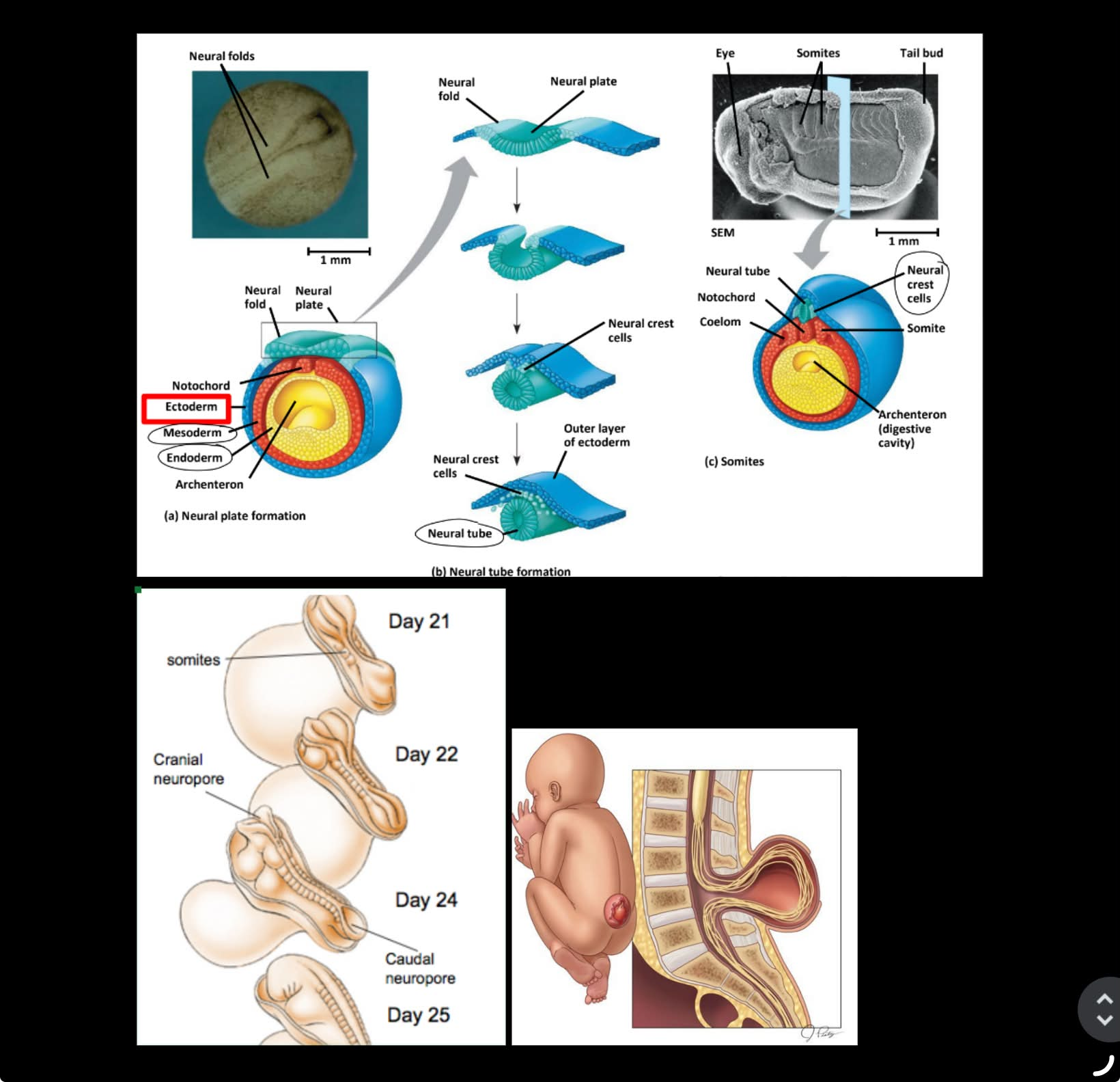 <ul><li><p>form the <strong><u>neural plate</u></strong> &amp; 3 germ layers: <strong><u>ectoderm, mesoderm, endoderm</u></strong></p></li><li><p>neural plate folds to → form <strong><u>neural tube</u></strong> <span style="color: purple;">(w/ ectoderm surrounding/encasing it)</span></p></li><li><p>form <strong><u>neural crest cells</u></strong> &amp; <strong><u>somites</u></strong> <span style="color: purple;">(somites from mesoderm)</span></p></li></ul><p>^^</p><p><strong>neural crest cells</strong> migrate away &amp; differentiate into PNS neurons</p><p><strong>neural tube closure</strong> starts in the center &amp; proceeds in the <u>caudal</u> &amp; <u>rostral</u> directions</p><p><u>spina bifida</u> results from <u>failing to complete neural tube formation/closure</u></p><ul><li><p>cause <u>defects in SC and spinal bones</u></p></li></ul><p>__</p><p>after development of neural tube, f<u>ore/mid/hindbrain will differentiate into the brain structures that are present in children &amp; adults</u> <span style="color: rgb(204, 200, 200);"><mark data-color="blue" style="background-color: blue; color: inherit;">(← picture in prev. flashcard)</mark></span></p>