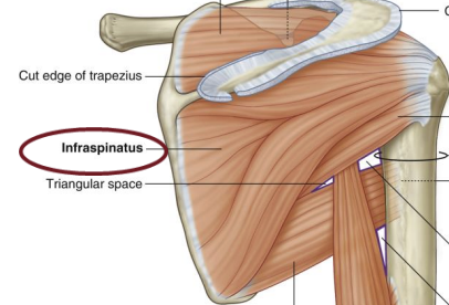 <p><span style="background-color: transparent;"><strong>Rotator Cuff Muscle: </strong>Infraspinatus</span></p>