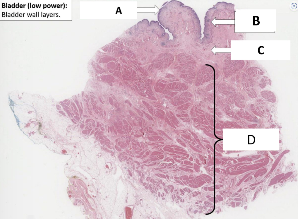 <p>Name the structure indicated by B.</p>