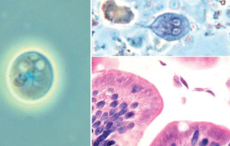 <p>Name this protist: defining morphologic features</p>