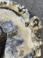 <p>What is the etiology of a subsolar abscess?</p>