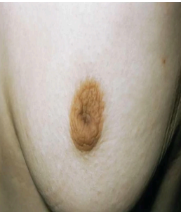 <p>What pathology?</p>