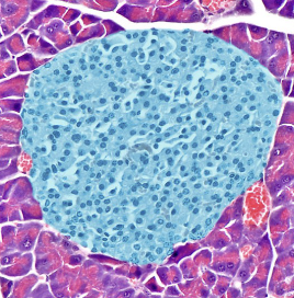 <p>pancreatic islet of langerhans </p>