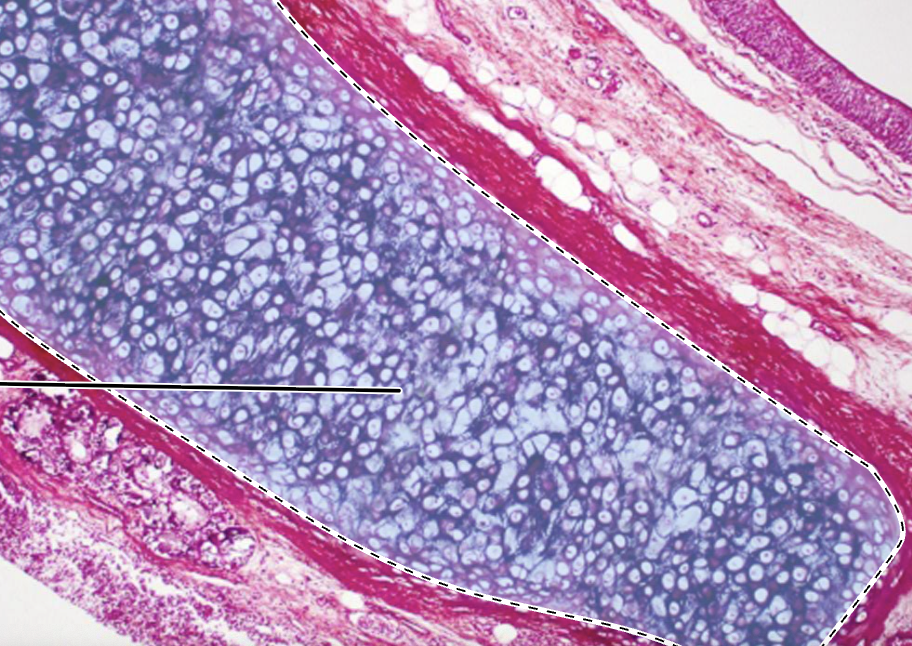 <p>highlighted tissue?</p>