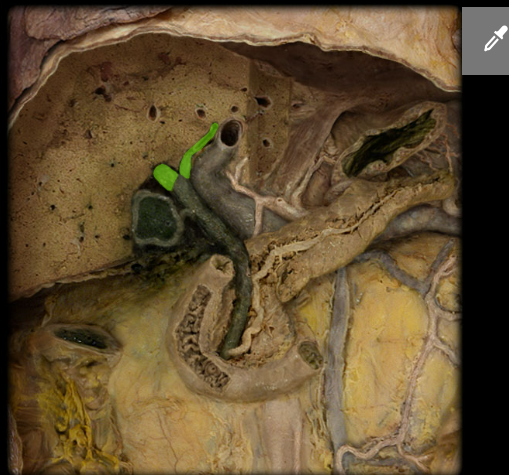<p><span>Hepatic duct</span></p>