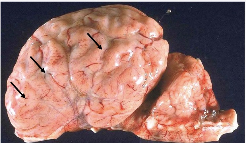 <p>morph this tissue from a calf</p>