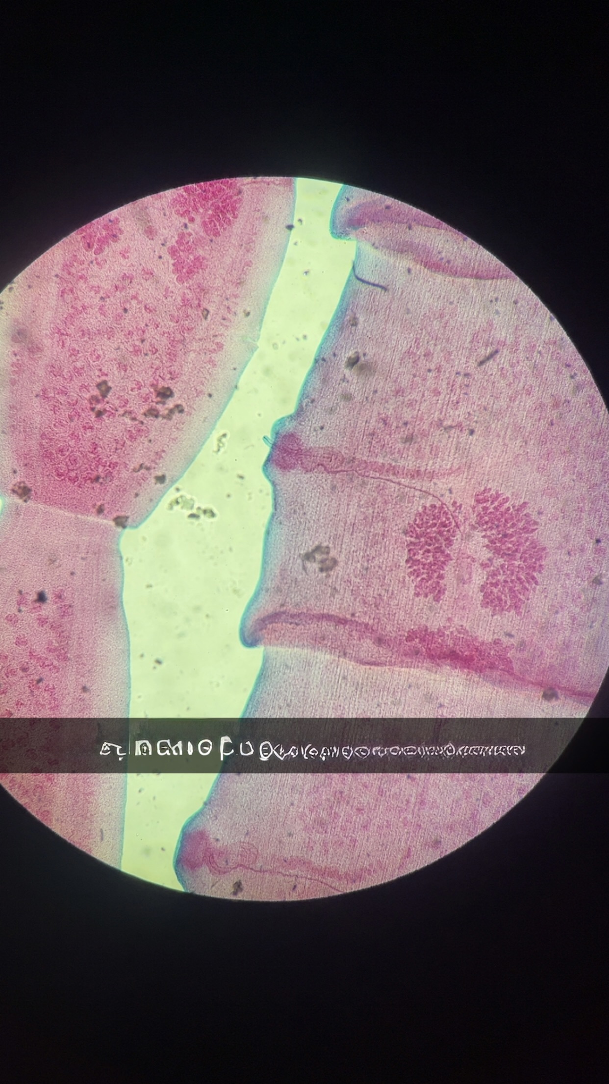 <p>what is this and what is its phylum </p>
