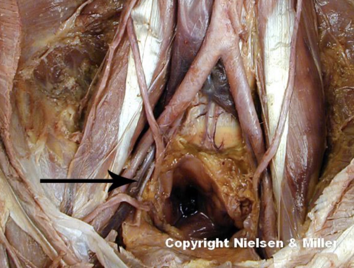 <p>The indicated vessel is the right _</p>