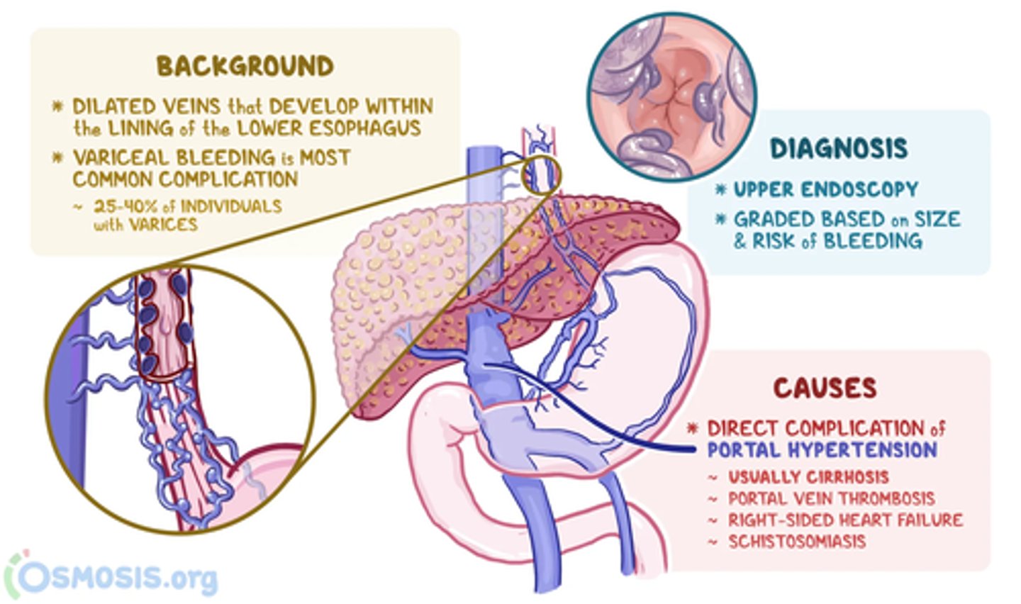 <p>C) Portal hypertension, often due to liver cirrhosis</p>