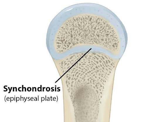 <ul><li><p>rigid, hyaline cartilage bridge units the bones</p></li><li><p>example: cartilaginous joint found between ends of the first pair of ribs + manubrium of the sternum (all other ribs are synovial joints)</p></li><li><p>example: epiphyseal plate found holding the epiphysis of a long bone to the diaphysis</p></li></ul><p></p>