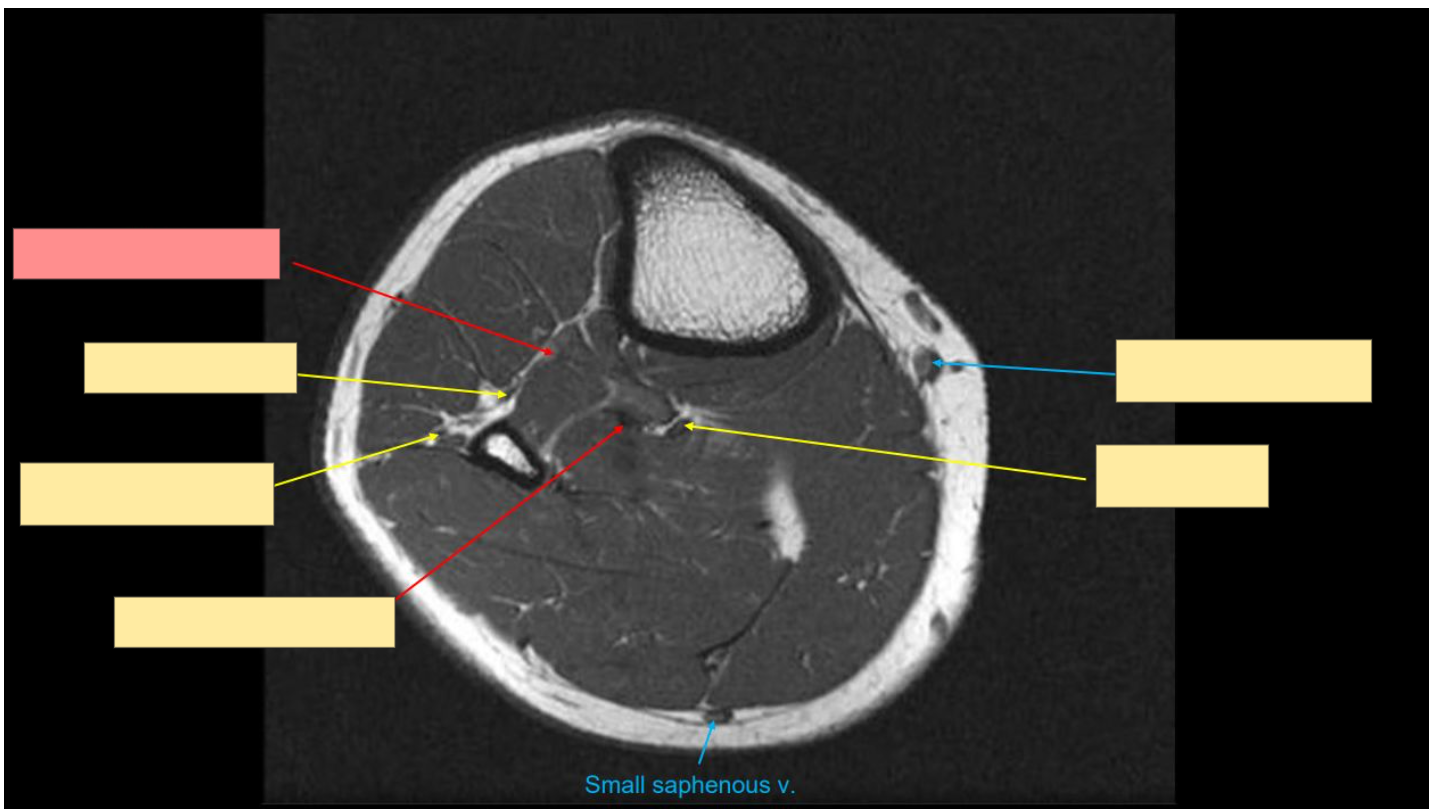 <p>Identify the structure </p>