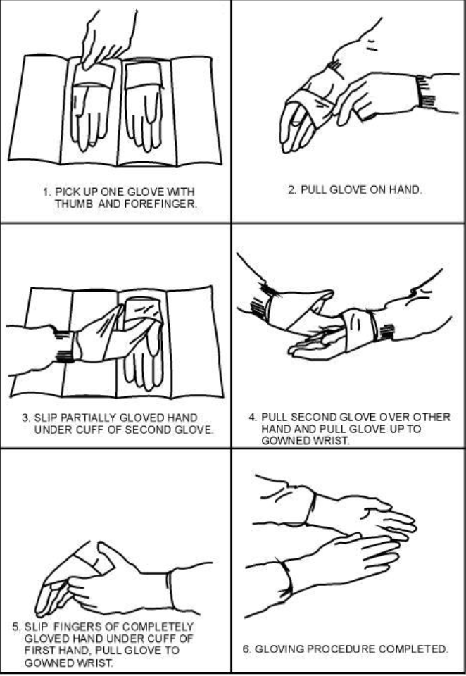 <p>what gloving technique is demonstrated</p>