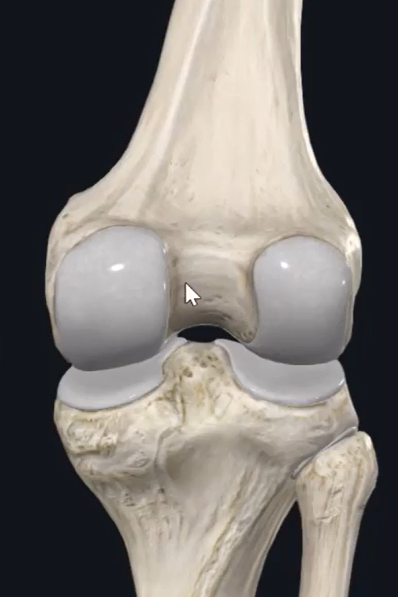 <p>what is the name of this fossa between the lateral and medial condyle when viewing the distal femur and proximal tibia from a posterior aspect?</p>
