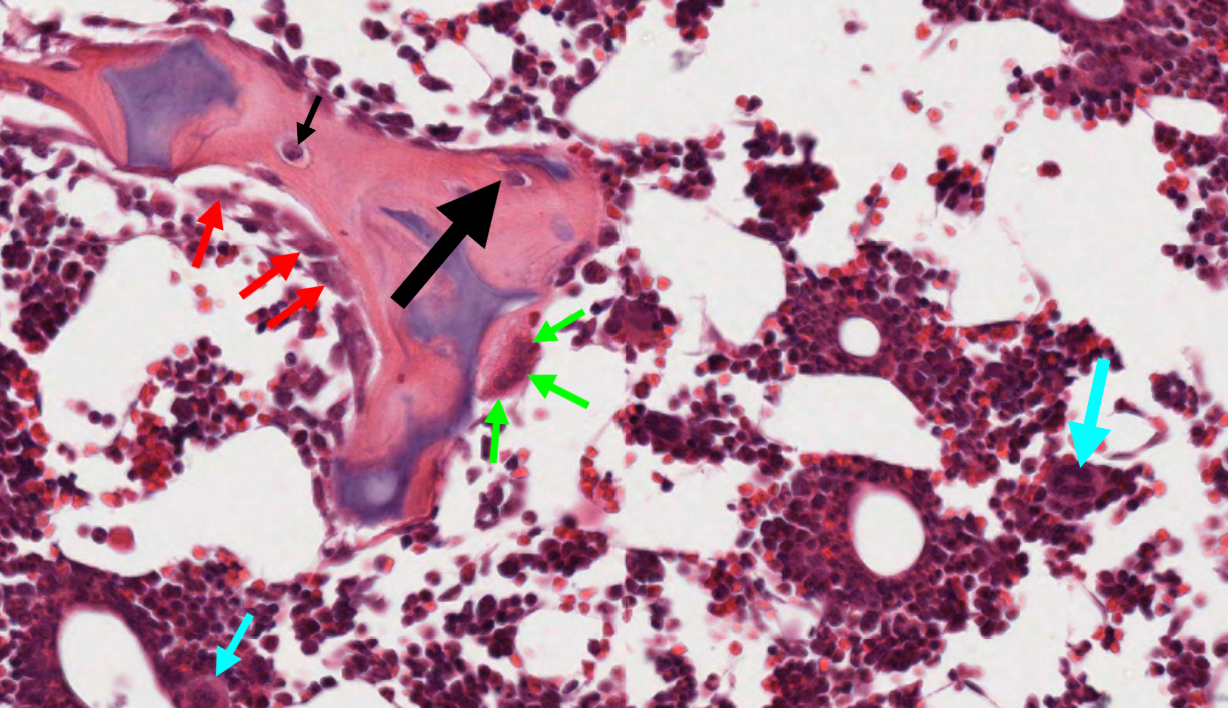 <p>What is pictured by the blue arrow on the slide? (Dog Vertebral Column)</p>