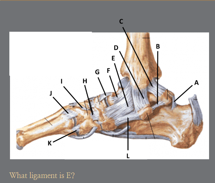 <p>E?</p>