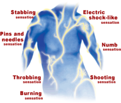 <p>Pain resulting from abnormal functioning or damage within the nervous system.</p>