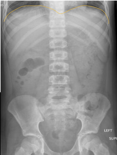 <p>What anatomy is outlined in this image?</p>